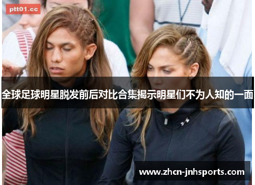 全球足球明星脱发前后对比合集揭示明星们不为人知的一面